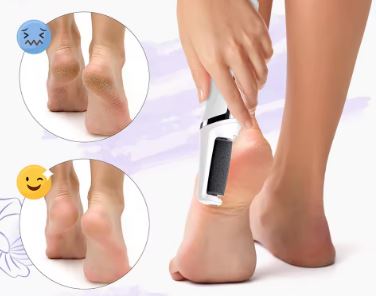 Lime Électrique Originale pour Pieds – Talons Doux en 2 Minutes | Rechargeable USB & Sans Douleur